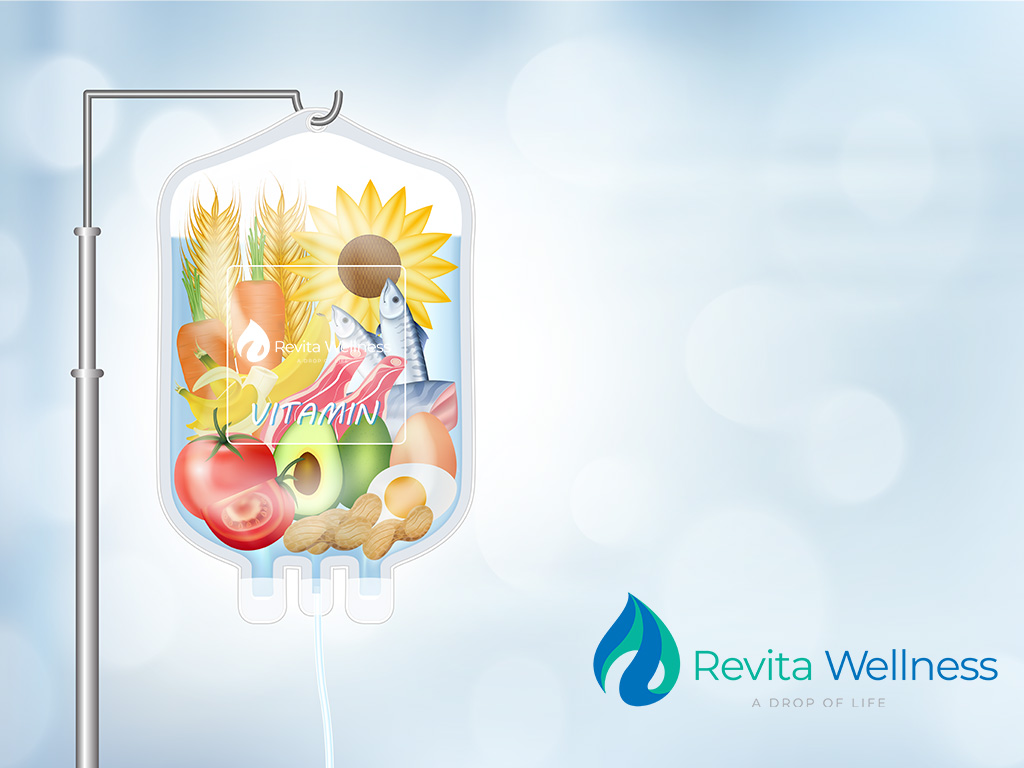 La terapia de infusión de vitaminas